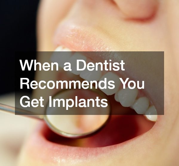 When a Dentist Recommends You Get Implants