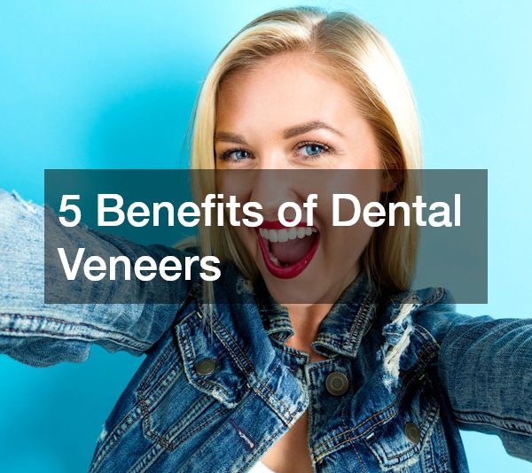 5 Benefits of Dental Veneers